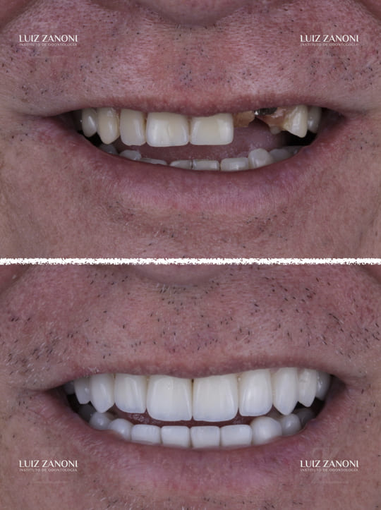 FINAIS CARLOS ROBERTO 1.001