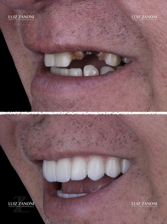 FINAIS CARLOS ROBERTO 1.003