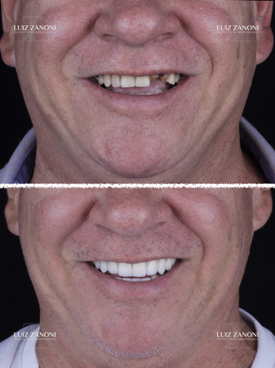 FINAIS CARLOS ROBERTO 1.005