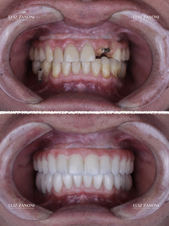 FINAIS CARLOS ROBERTO 1.010