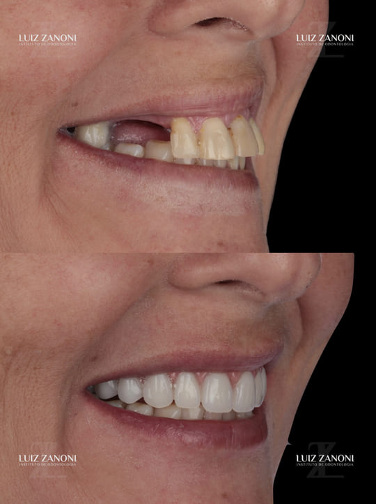 FINAIS DAIANE PERIN.003