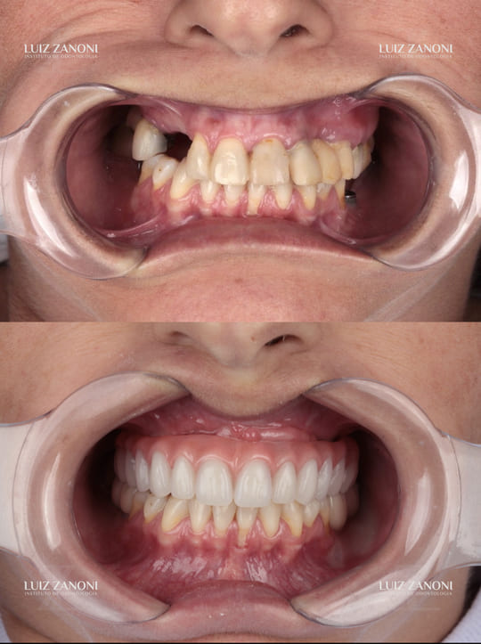 FINAIS DAIANE PERIN.005