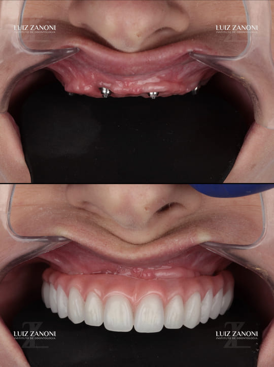 finais daiane perin.001 (1)