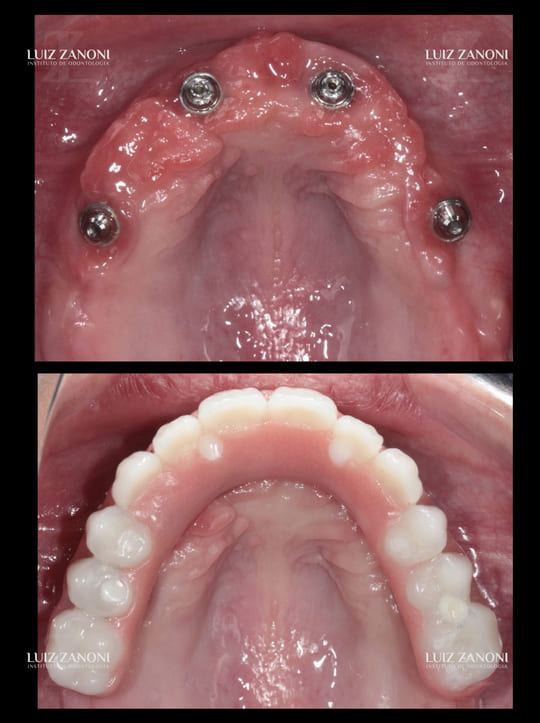 finais daiane perin.002